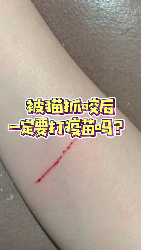 被猫挠了出血了怎么处理